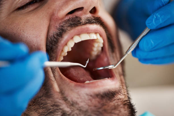 Best Emergency Cosmetic Dentistry (e.g., broken veneers) in Northview, MI